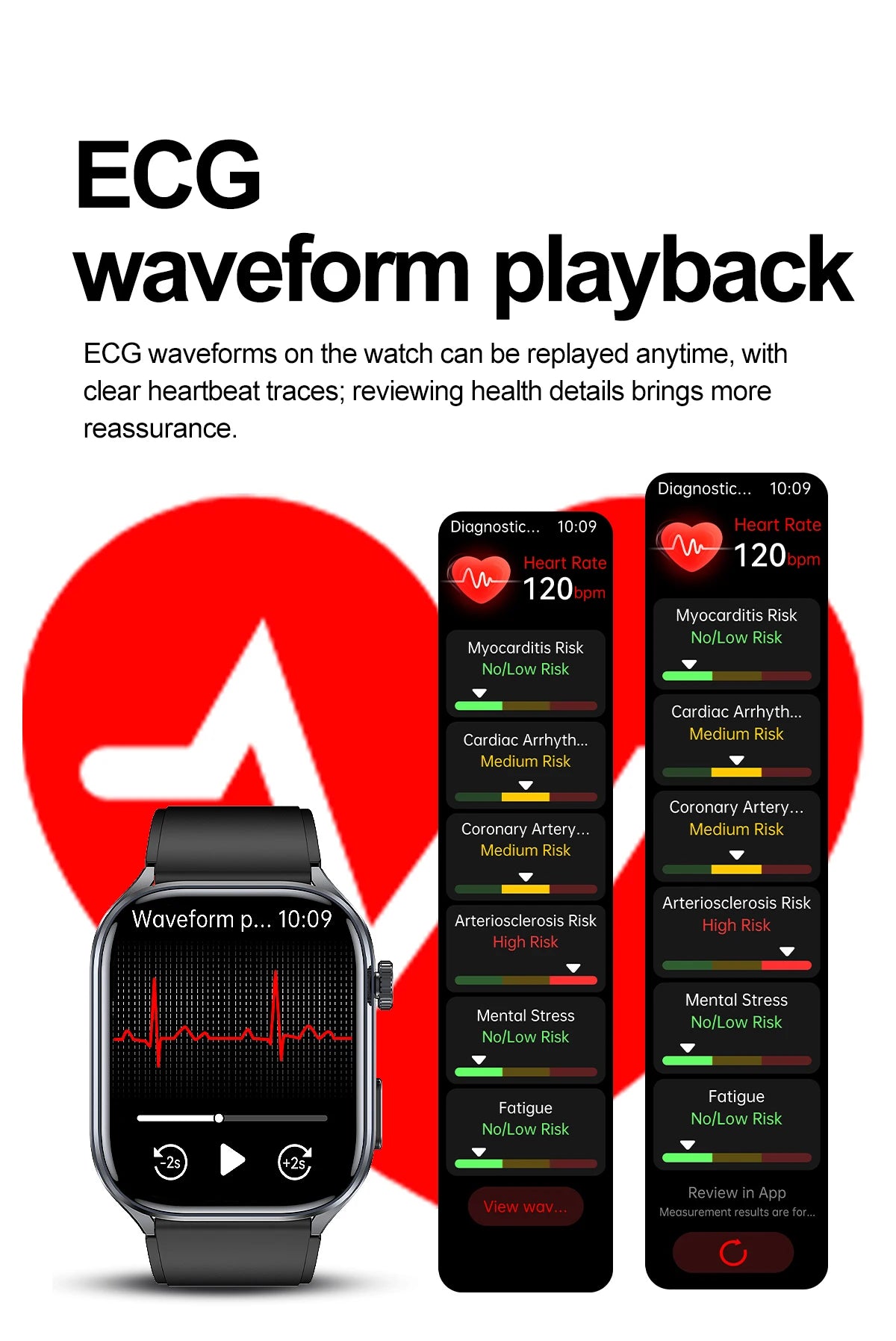 2026 New Accurate ECG Smart Watch Heart Health Analysis Blood analysis Blood Lipid Blood Pressure BT call Smart Watches For Men
