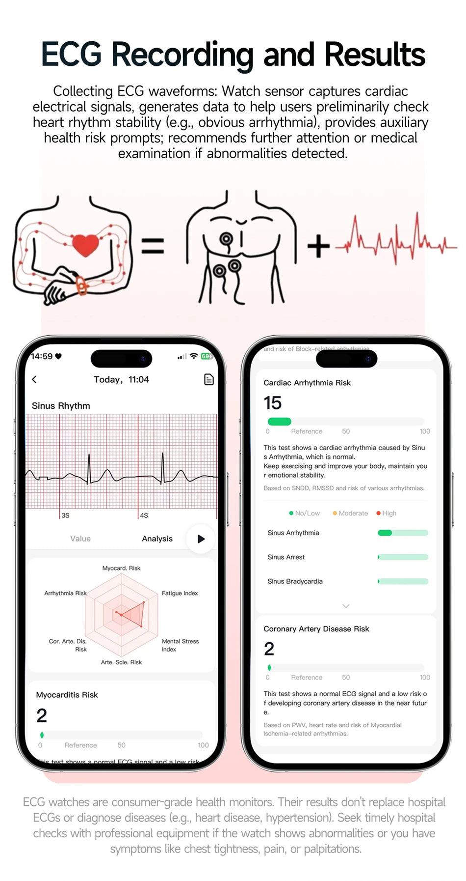 New Men Accurate Health Diagnosis ECG Smart Watch Blood Pressure Blood Oxygen Blood Fat Uric Acid Temp Bluetooth call Smartwatch