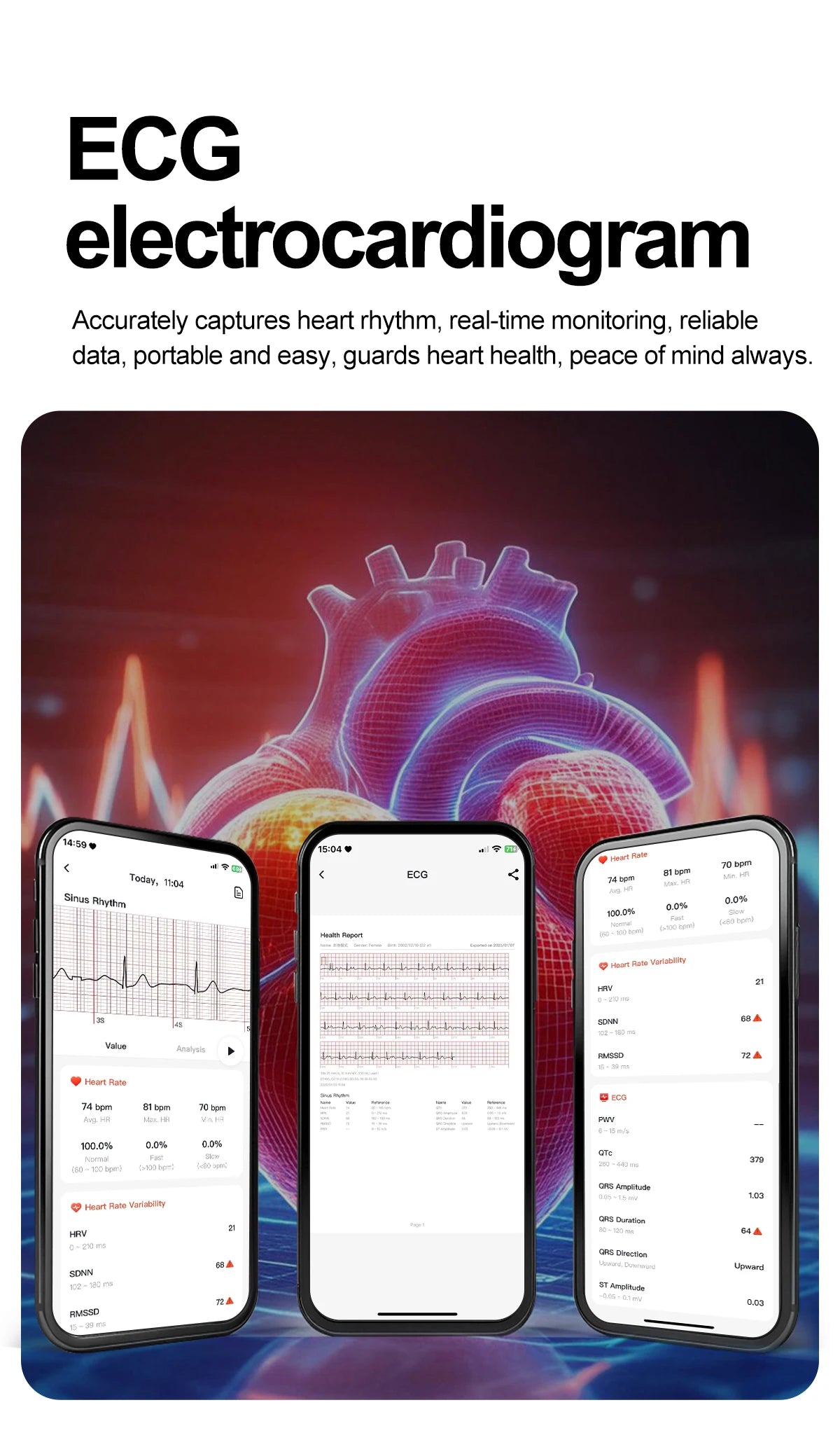 2026 New Accurate ECG Smart Watch Heart Health Analysis Blood analysis Blood Lipid Blood Pressure BT call Smart Watches For Men